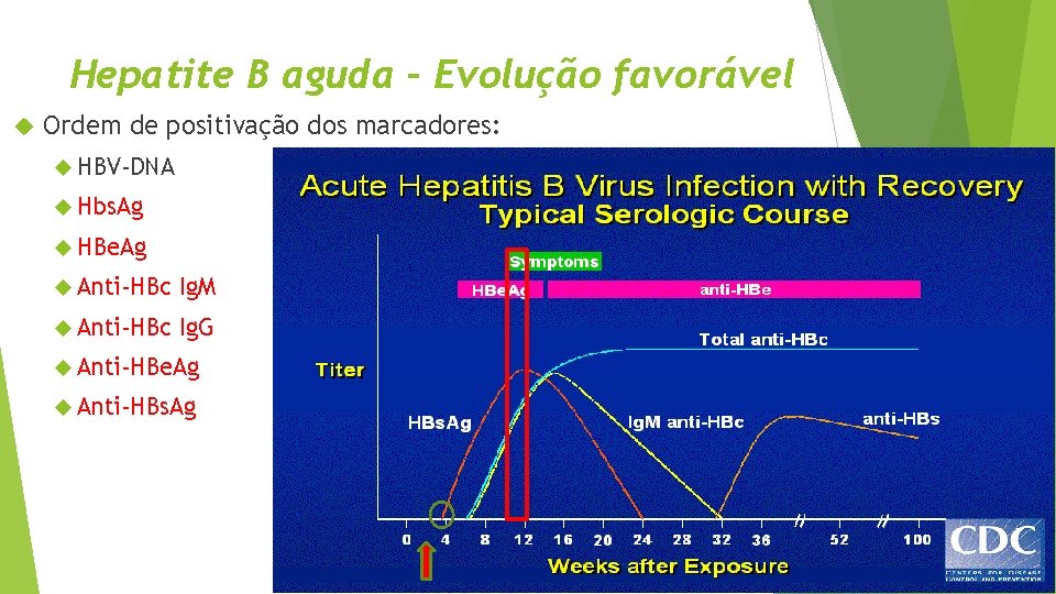 Hepatite B aguda – Evolução favorável Ordem de positivação dos marcadores: HBV-DNA Hbs. Ag