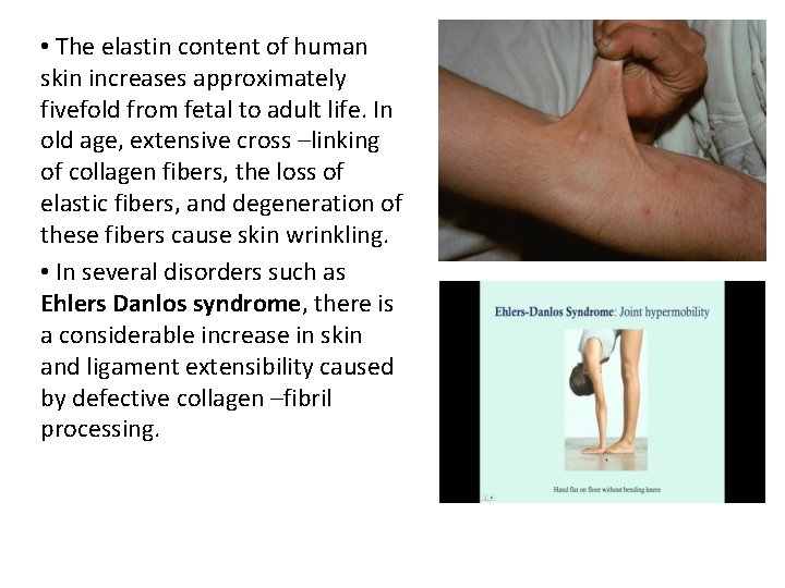  • The elastin content of human skin increases approximately fivefold from fetal to