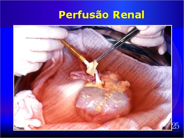 Perfusão Renal 