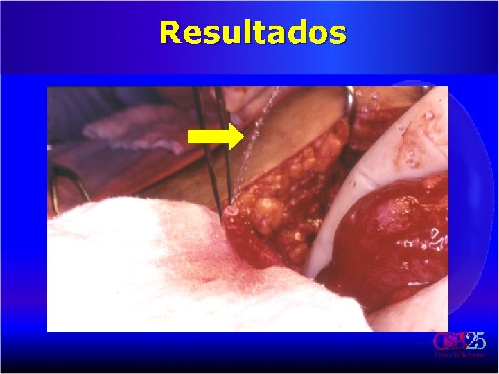 Resultados 