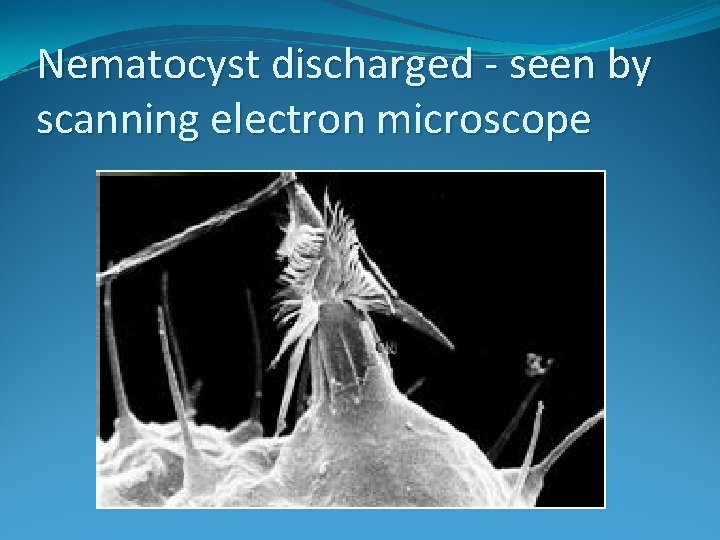 Nematocyst discharged - seen by scanning electron microscope 