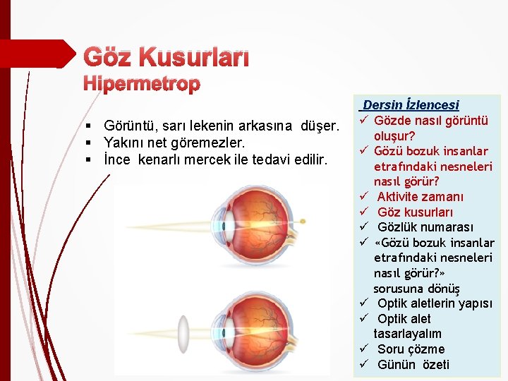 Göz Kusurları Hipermetrop § Görüntü, sarı lekenin arkasına düşer. § Yakını net göremezler. §