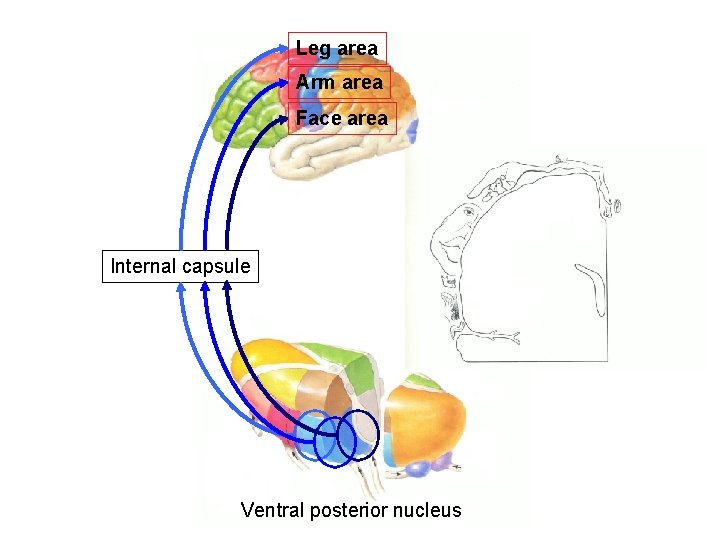 Leg area Arm area Face area Internal capsule Ventral posterior nucleus 