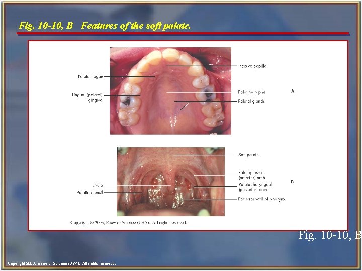Fig. 10 -10, B Features of the soft palate. Fig. 10 -10, B Copyright Fig. 10 -10, B Features of the soft palate. Fig. 10 -10, B Copyright
