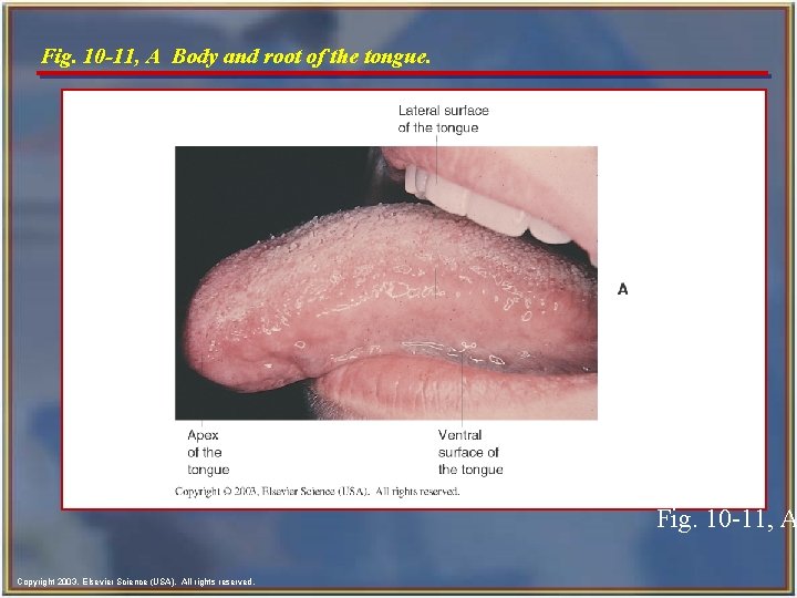Fig. 10 -11, A Body and root of the tongue. Fig. 10 -11, A Fig. 10 -11, A Body and root of the tongue. Fig. 10 -11, A
