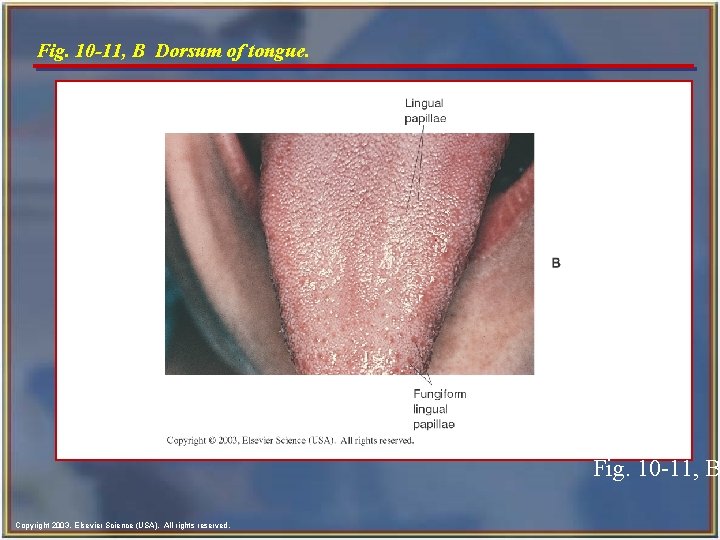 Fig. 10 -11, B Dorsum of tongue. Fig. 10 -11, B Copyright 2003, Elsevier Fig. 10 -11, B Dorsum of tongue. Fig. 10 -11, B Copyright 2003, Elsevier
