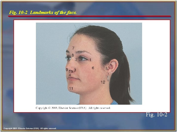 Fig. 10 -2 Landmarks of the face. Fig. 10 -2 Copyright 2003, Elsevier Science Fig. 10 -2 Landmarks of the face. Fig. 10 -2 Copyright 2003, Elsevier Science