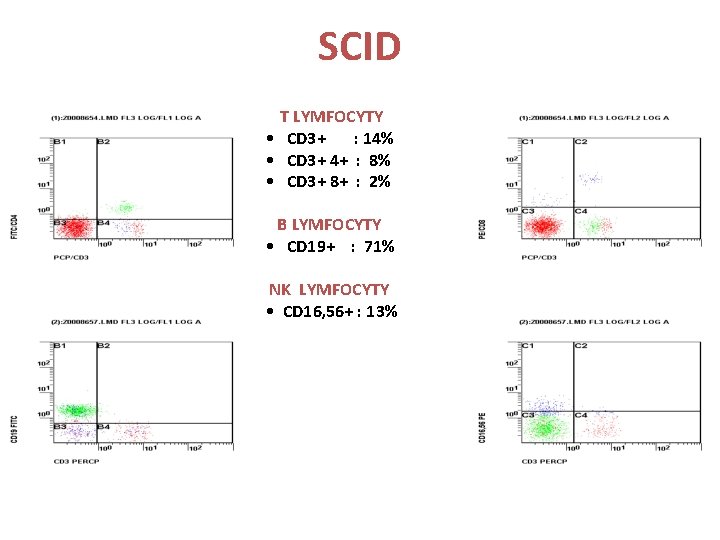SCID T LYMFOCYTY • CD 3+ : 14% • CD 3+ 4+ : 8%