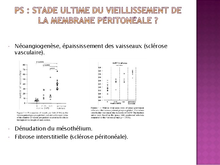  Néoangiogenèse, épaississement des vaisseaux (sclérose vasculaire). Dénudation du mésothélium. Fibrose interstitielle (sclérose péritonéale).