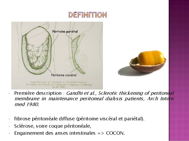  Première description : Gandhi et al. , Sclerotic thickening of peritoneal fibrose péritonéale