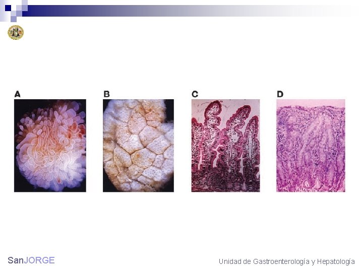 San. JORGE Unidad de Gastroenterología y Hepatología 
