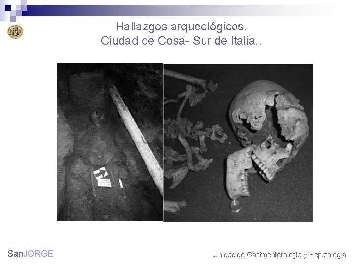 Hallazgos arqueológicos. Ciudad de Cosa- Sur de Italia. . San. JORGE Unidad de Gastroenterología