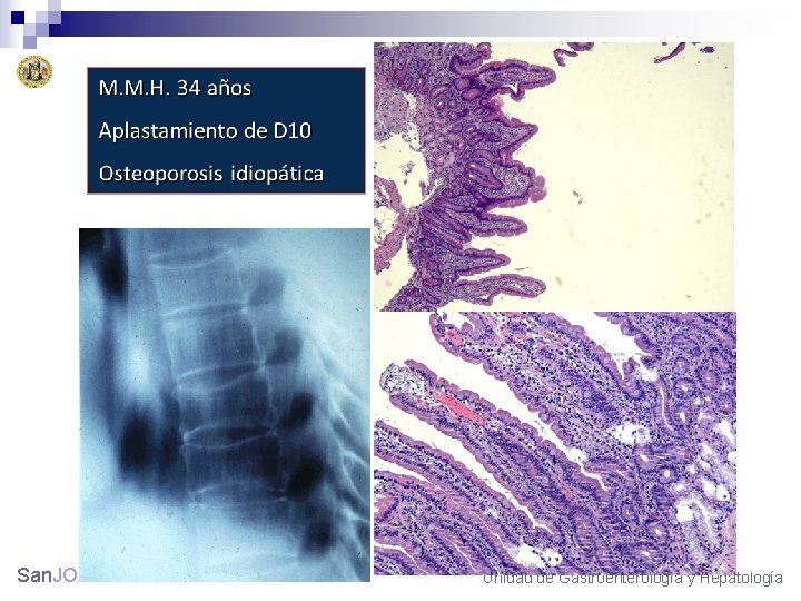 San. JORGE Unidad de Gastroenterología y Hepatología 