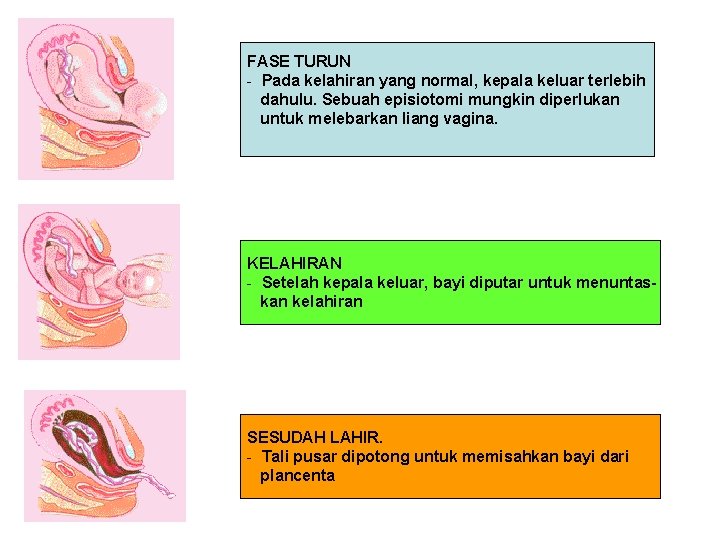 FASE TURUN - Pada kelahiran yang normal, kepala keluar terlebih dahulu. Sebuah episiotomi mungkin