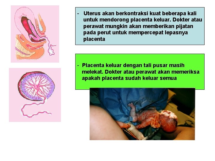 - Uterus akan berkontraksi kuat beberapa kali untuk mendorong placenta keluar. Dokter atau perawat
