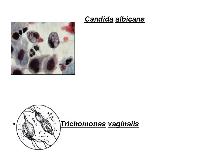 Candida albicans • • Trichomonas vaginalis 