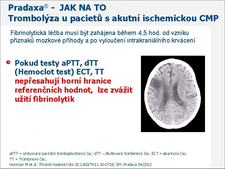 Pradaxa® - JAK NA TO Trombolýza u pacietů s akutní ischemickou CMP Fibrinolytická léčba