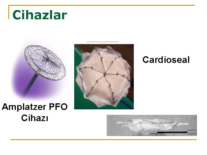 Cihazlar Cardioseal Amplatzer PFO Cihazı 