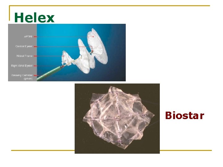 Helex Biostar 