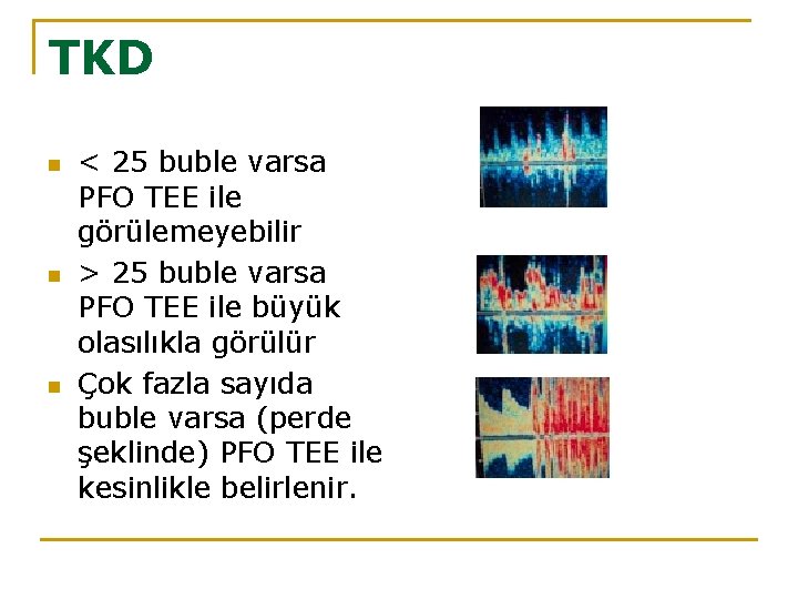 TKD n n n < 25 buble varsa PFO TEE ile görülemeyebilir > 25