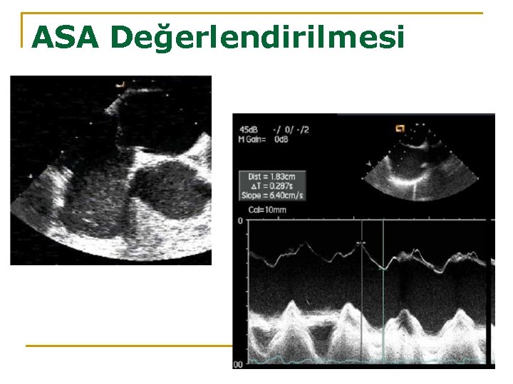 ASA Değerlendirilmesi 