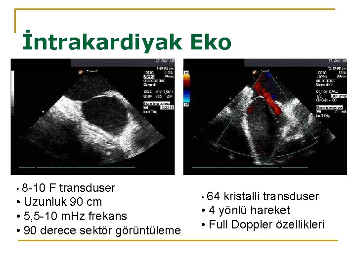 İntrakardiyak Eko • 8 -10 F transduser • Uzunluk 90 cm • 5, 5