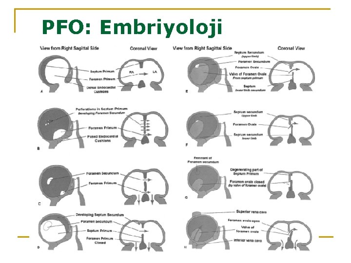 PFO: Embriyoloji 