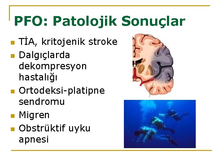 PFO: Patolojik Sonuçlar n n n TİA, kritojenik stroke Dalgıçlarda dekompresyon hastalığı Ortodeksi-platipne sendromu