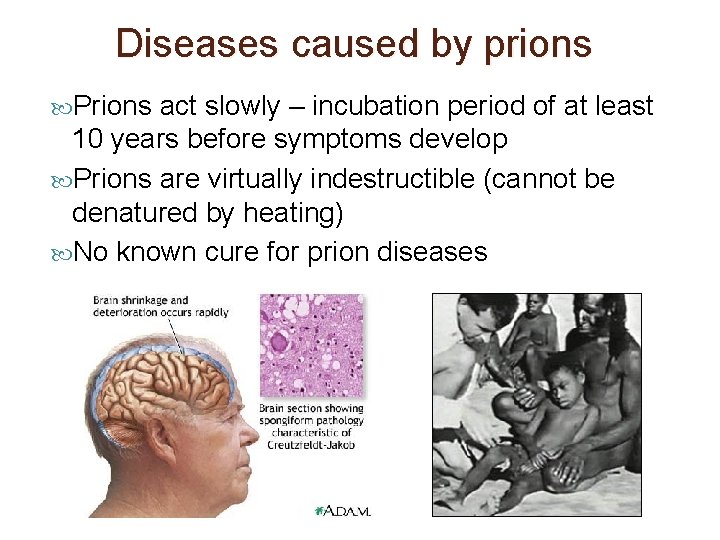 Diseases caused by prions Prions act slowly – incubation period of at least 10