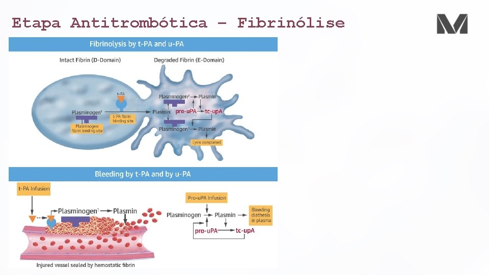 Etapa Antitrombótica – Fibrinólise 