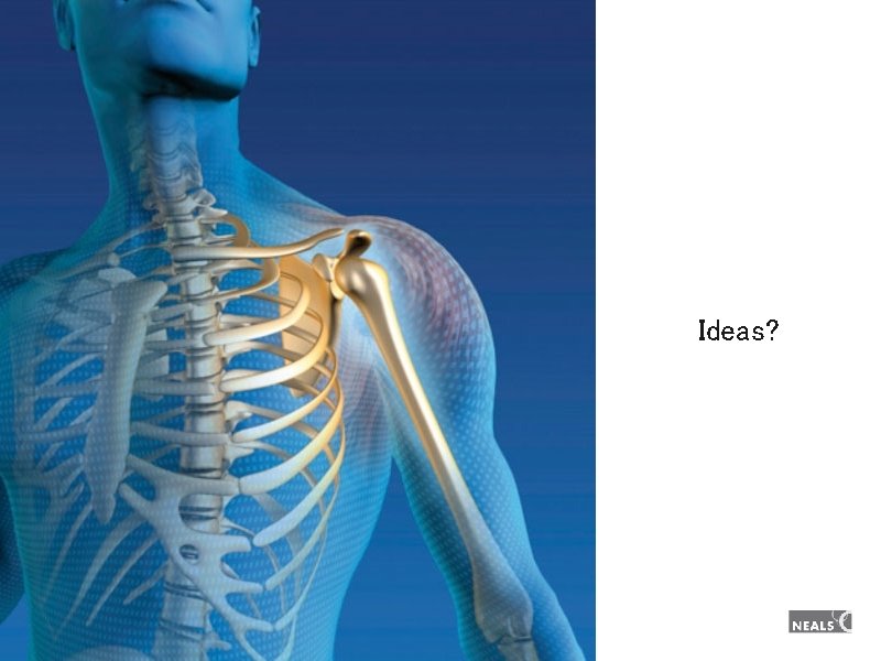 Ideas? Ideas?