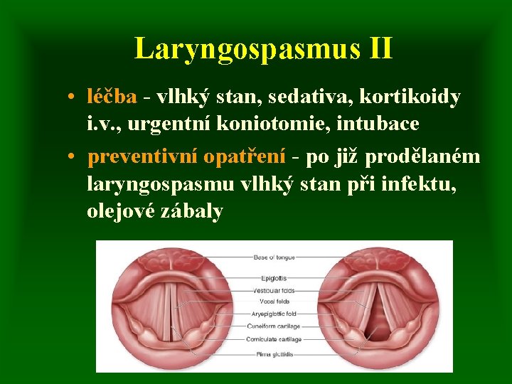 Laryngospasmus II • léčba - vlhký stan, sedativa, kortikoidy i. v. , urgentní koniotomie,