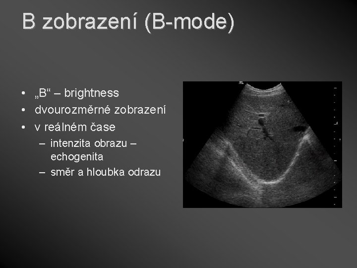 B zobrazení (B-mode) • „B“ – brightness • dvourozměrné zobrazení • v reálném čase