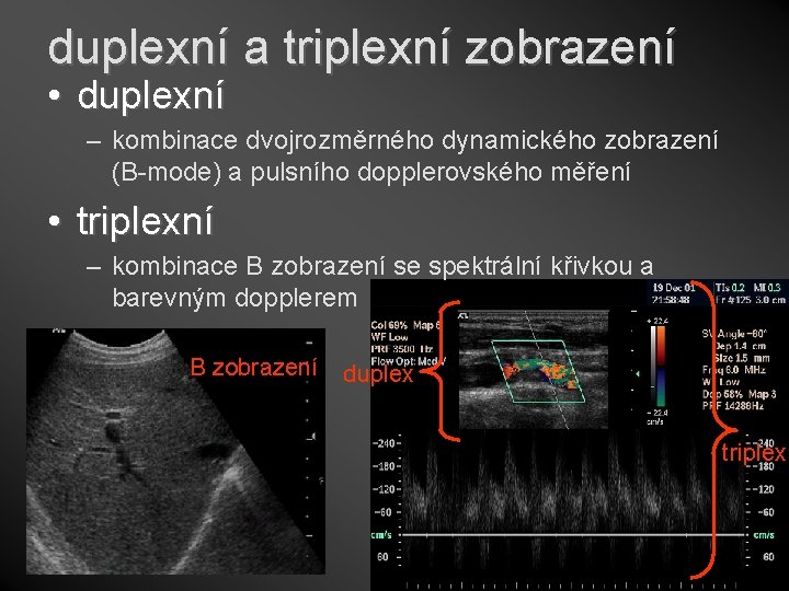 duplexní a triplexní zobrazení • duplexní – kombinace dvojrozměrného dynamického zobrazení (B-mode) a pulsního