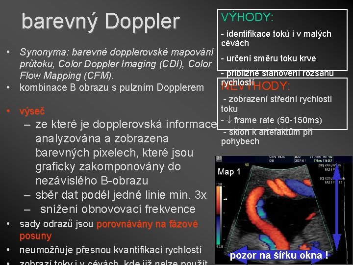 barevný Doppler • Synonyma: barevné dopplerovské mapování průtoku, Color Doppler Imaging (CDI), Color Flow