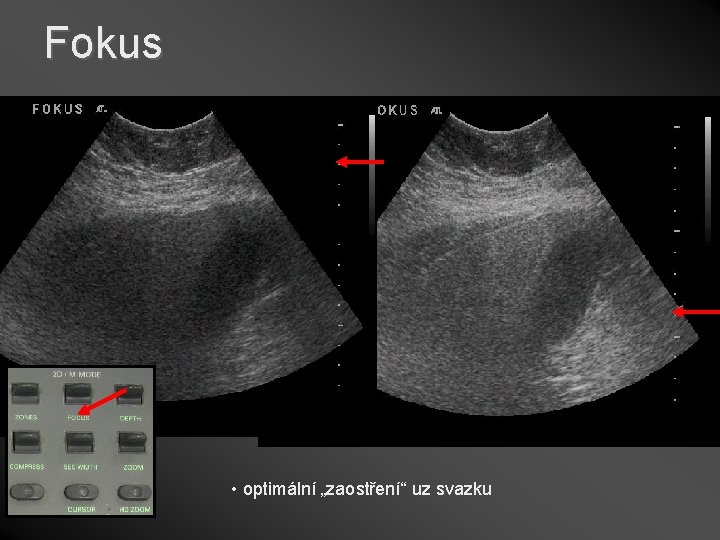 Fokus • optimální „zaostření“ uz svazku 