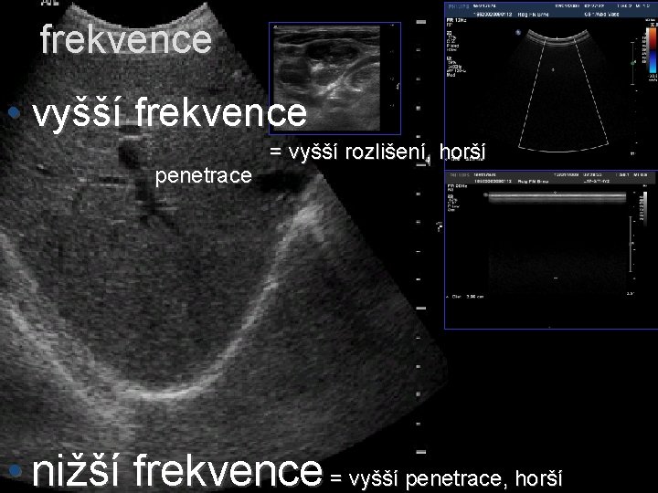 frekvence • vyšší frekvence penetrace = vyšší rozlišení, horší • nižší frekvence = vyšší