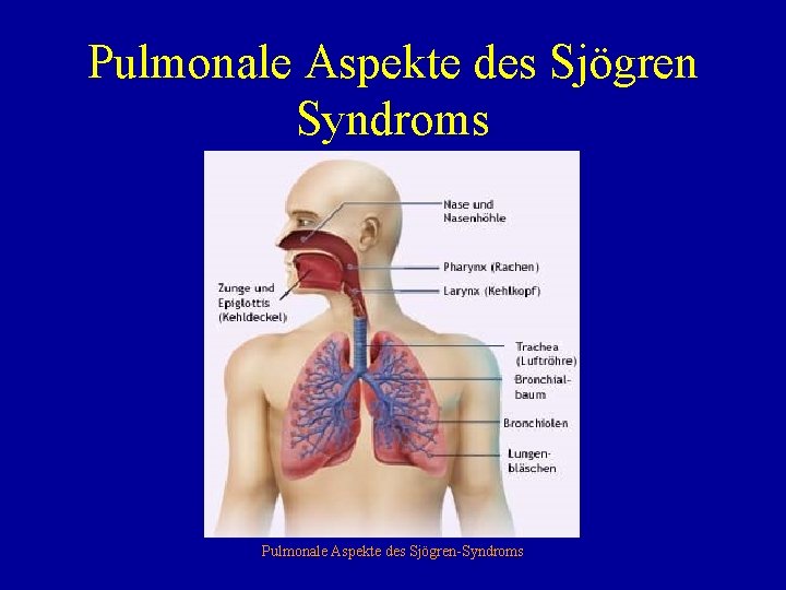 Pulmonale Aspekte des Sjögren Syndroms Pulmonale Aspekte des Sjögren-Syndroms 