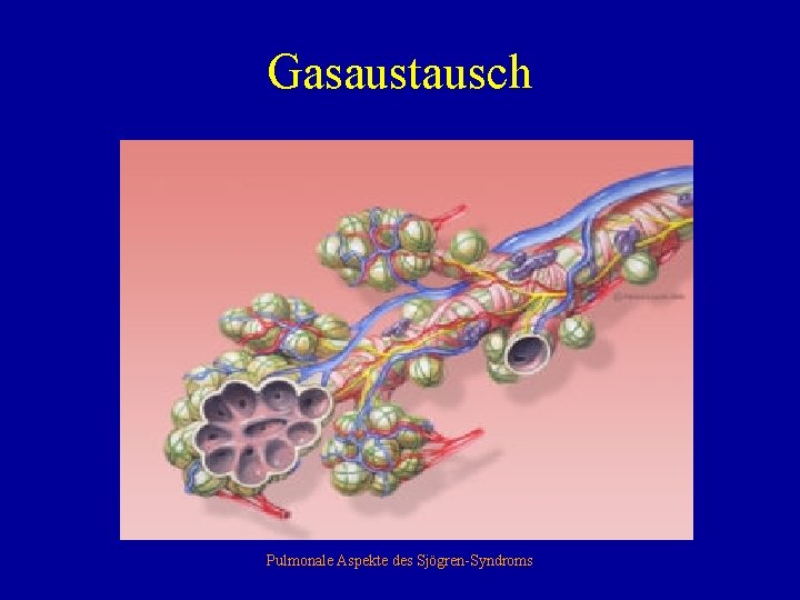 Gasaustausch Pulmonale Aspekte des Sjögren-Syndroms 