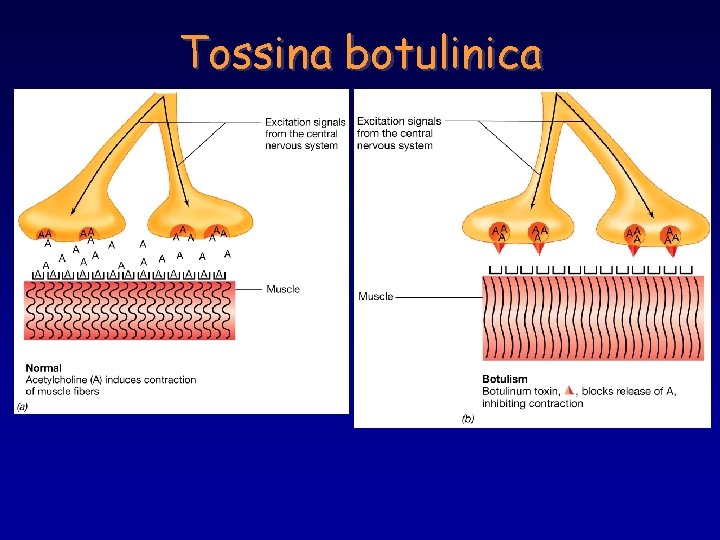 Tossina botulinica 