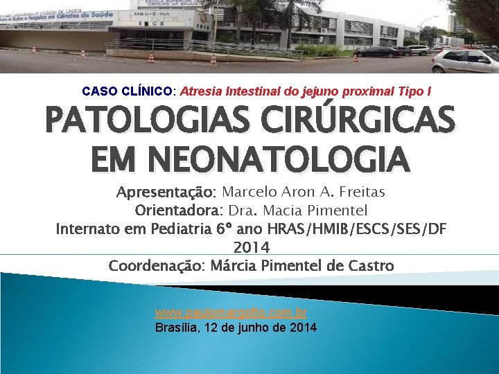 CASO CLÍNICO: Atresia Intestinal do jejuno proximal Tipo I PATOLOGIAS CIRÚRGICAS EM NEONATOLOGIA Apresentação: