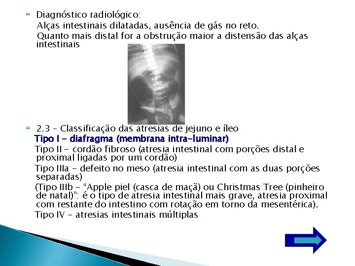  Diagnóstico radiológico: Alças intestinais dilatadas, ausência de gás no reto. Quanto mais distal