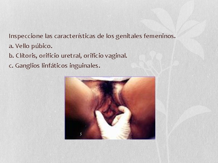 Inspeccione las características de los genitales femeninos. a. Vello púbico. b. Clítoris, orificio uretral, Inspeccione las características de los genitales femeninos. a. Vello púbico. b. Clítoris, orificio uretral,