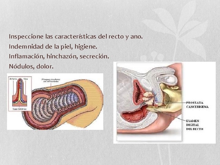 Inspeccione las características del recto y ano. Indemnidad de la piel, higiene. Inflamación, hinchazón, Inspeccione las características del recto y ano. Indemnidad de la piel, higiene. Inflamación, hinchazón,