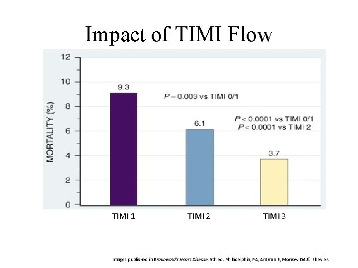Impact of TIMI Flow TIMI 1 TIMI 2 TIMI 3 Images published in Braunwald's