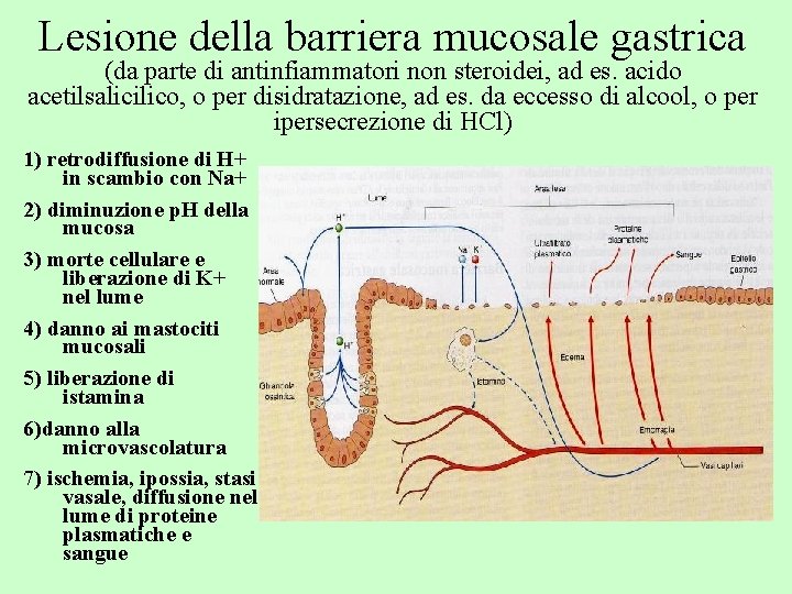 Lesione della barriera mucosale gastrica (da parte di antinfiammatori non steroidei, ad es. acido