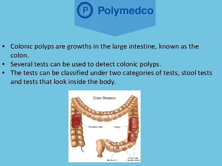  • Colonic polyps are growths in the large intestine, known as the colon.