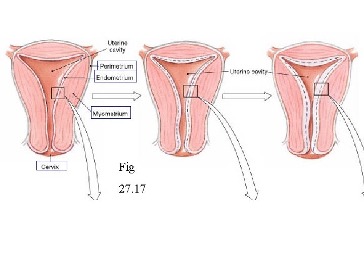 Fig 27. 17 