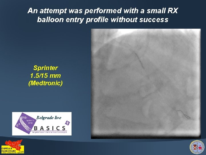 An attempt was performed with a small RX balloon entry profile without success Sprinter