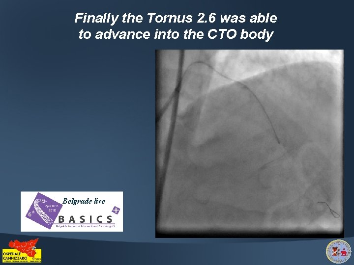 Finally the Tornus 2. 6 was able to advance into the CTO body Belgrade